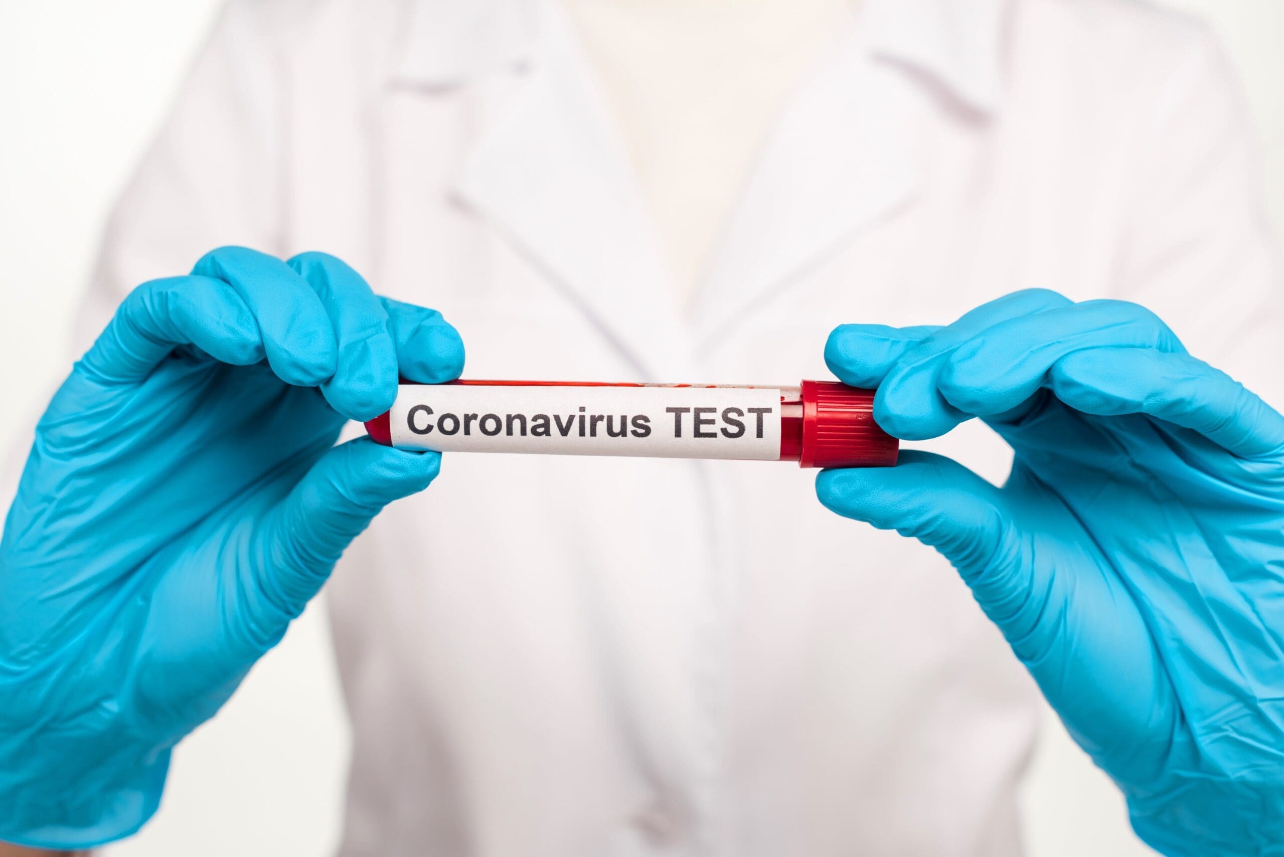 Gloved hands in a white lab coat hold a red-capped blood collection tube labeled "Coronavirus TEST.